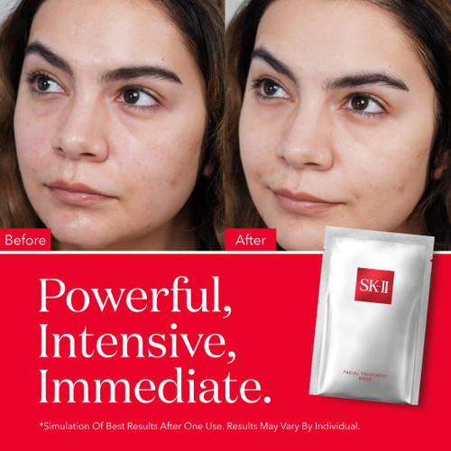 SK-II Facial Treatment Mask: Skin care sheet serum mask for dullness, dryness, and uneven skin tone slider2